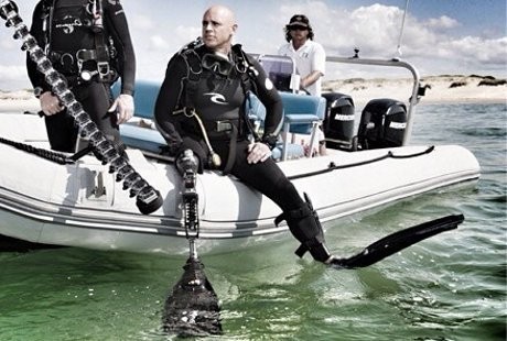 Hebat! 2 Hari Pasca Tangan dan Kakinya Hilang Digigit Hiu, Paul Bisa Push-up