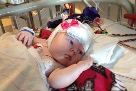 Sering Kejang Sejak Lahir, Bayi Berusia 3 Bulan Ini Harus Operasi Otak