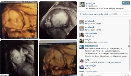 Gisel Hamil Anak Perempuan