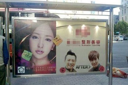 Wajah Lee Min Ho Jadi Iklan Klinik Operasi Plastik di Tiongkok