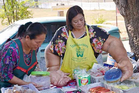 Idap Kelainan Langka, Tangan Wanita Ini Membesar dan Beratnya Capai 9,5 Kg