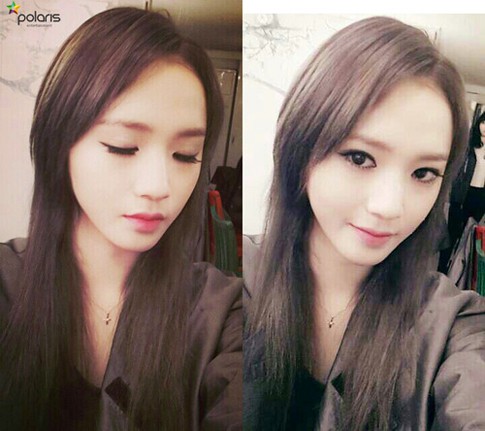 Operasi Wajah Sojung Ladies Code Berjalan Lancar