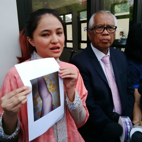 Marshanda Tunjukkan Foto Bukti KDRT yang Dituduhkan pada Ben