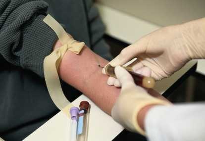 Tak Bisa Sembarangan, Pemberian Obat Kemoterapi Juga Ada Syaratnya