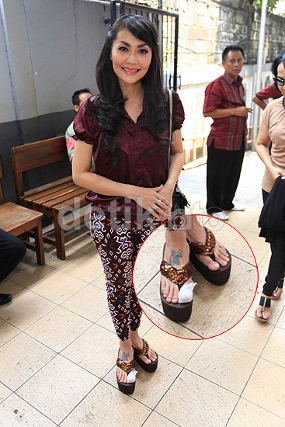 Tessa Kaunang: Tak Hanya Luka Hati, Tapi Juga Luka Kaki