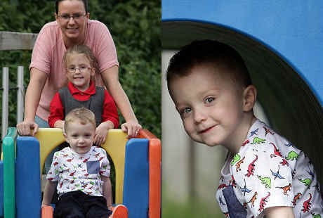 Bukan Sehat, Anak Ini Hanya Bisa Makan Wortel dan Pisang karena Alergi Langka