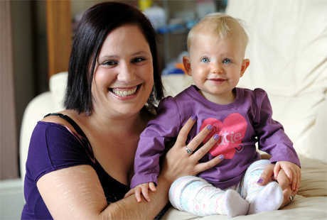 Lahir dengan Kondisi Langka, Tengkorak Bocah Ini Harus Dimodifikasi