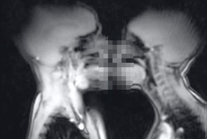 Ketika Aktivitas Hubungan Intim Direkam Melalui Scan MRI