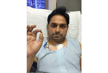 Astaga! Peluru Bersarang di Jantung Pria Ini Selama Dua Bulan