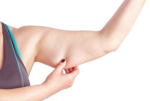 Rahasia Agar Lengan Tak Bergelambir Setelah Sukses Turunkan Berat Badan