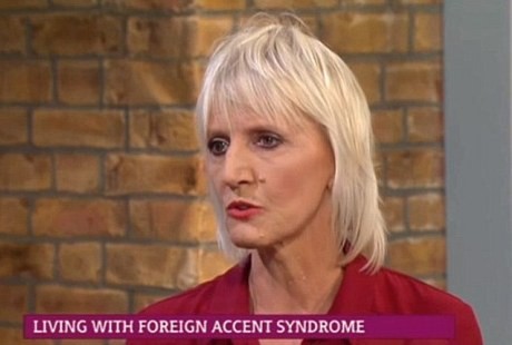 Karena Penyakit Langka, Wanita Inggris Ini Mendadak Berlogat Polandia