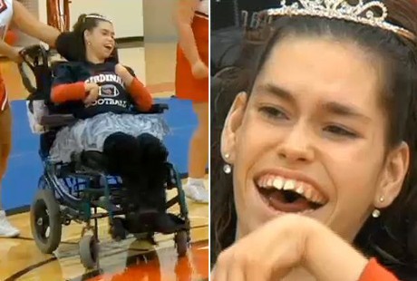 Jade Kilburg, Gadis dengan Kerusakan Otak yang Jadi Ratu Sekolah