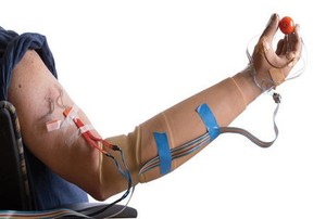 Bukan Sekadar Pengganti Organ, Tangan Bionik Ini Punya Perasaan Lho