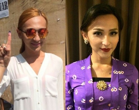 Dena Rachman Akhirnya Implan Payudara