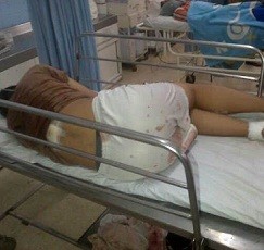 Bentrok Antar SMK, 2 Pelajar Kritis Kepala Tertancap Celurit