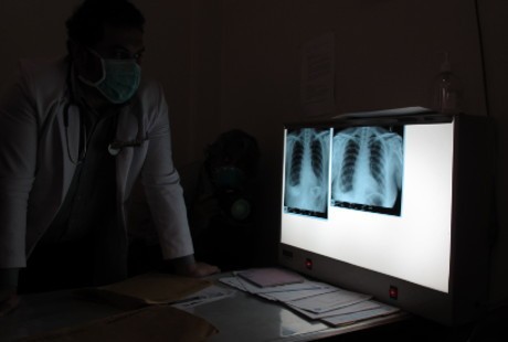 Ini yang Bisa Dilakukan Ahok untuk Bantu Kendalikan TBC di Jakarta