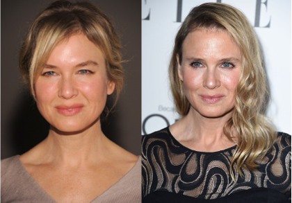 Nyaris Tak Dikenali, Renee Zellweger Jawab Kabar Operasi Plastik