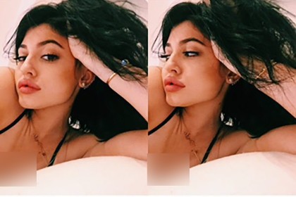 Bibir Nampak Lebih Tebal, Kylie Jenner Kembali Diduga Operasi Plastik