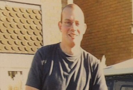 Alergi Parah, Steven Meninggal Usai Disengat Seekor Lebah