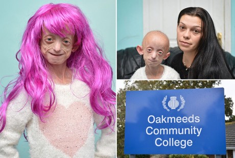 Ashanti, Gadis 11 Tahun Berwajah Nenek-nenek yang Disuruh Lepas Rambut Palsu