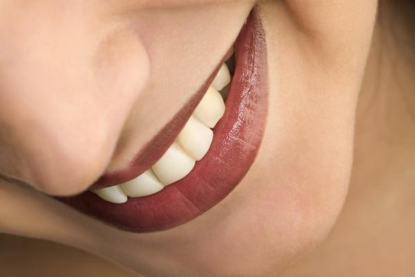 Seringlah Makan Apel dan Brokoli Agar Gigi Putih Bersih (1)