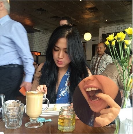 Pernikahan Dibatalkan Ludwig, Jessica Habis Jalani Operasi