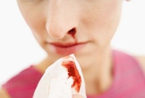 Ini Bedanya Anak Mimisan karena Demam dan Hemofilia