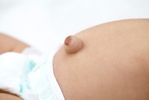 Udel Bayi Keluar dan Membesar, Tanda Hernia
