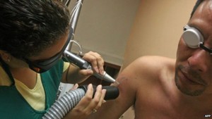 Menghapus Tato di Penjara Selandia Baru, Napi Dapat Diskon