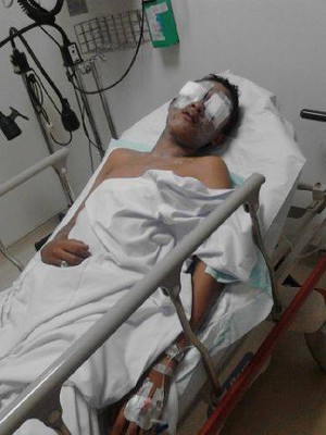 Disdik DKI Jakarta Ingin Temui Penyiram Air Keras Siswi STM Budi Utomo