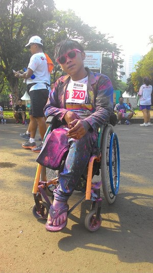 Kisah Rio, Tetap Semangat Ikut Lomba Lari Meski Kakinya Tak Utuh Lagi