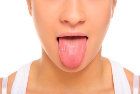 Cadel karena Lidah Pendek? Begini Solusinya Menurut Dokter