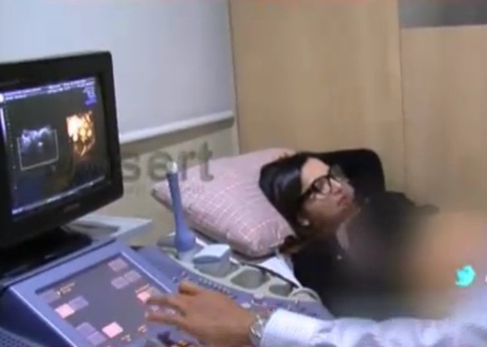 Lihat Anak Lewat USG, Ashanty Klaim Punya Wajah Mirip