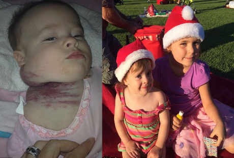 Dikira Memar Biasa, Ternyata Ada Tumor Langka di Leher Bocah Ini