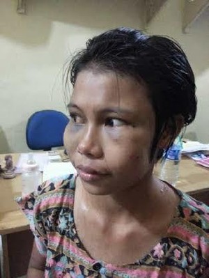 Dipukuli dan Disetrika, PRT di Medan Mengadu ke Polisi