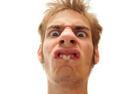 Tonggos, Gigi Maju karena Rahang Kekecilan atau Gigi Kebesaran