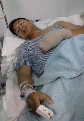 Ada Mukjizat dalam Kecelakaan Fero Walandouw