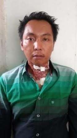 Dugaan Penganiayaan, Kuswanto dan 18 Saksi Diperiksa Polda Jateng