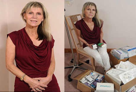 9 Organ Wanita Ini Diangkat Demi Sembuh dari Kanker Langka