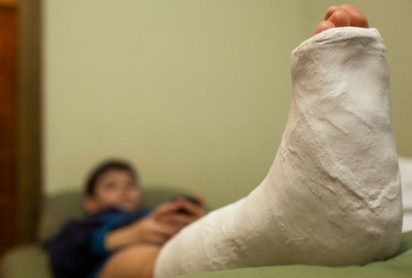 Penyakit Kaki Gajah Sangat Mudah Diberantas, Tapi di Indonesia Kok Awet?