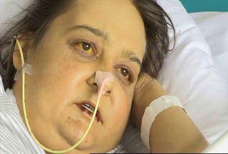 Biasa Sarapan Vodka, Wanita Ini Beri Tahu Bahaya Kecanduan Alkohol