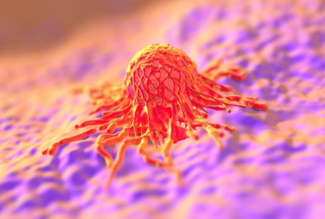 Peneliti Sebut 65 Persen Kasus Kanker Muncul karena Kesialan