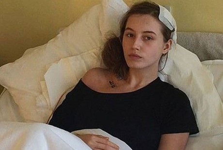 Sedang Dioperasi, Gadis 19 Tahun Terbangun dan Bicara pada Dokter