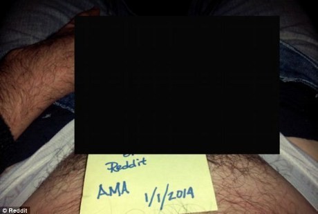 Pria Bisa Punya Kemaluan Ganda, Wanita Juga Bisa Punya Rahim Ganda