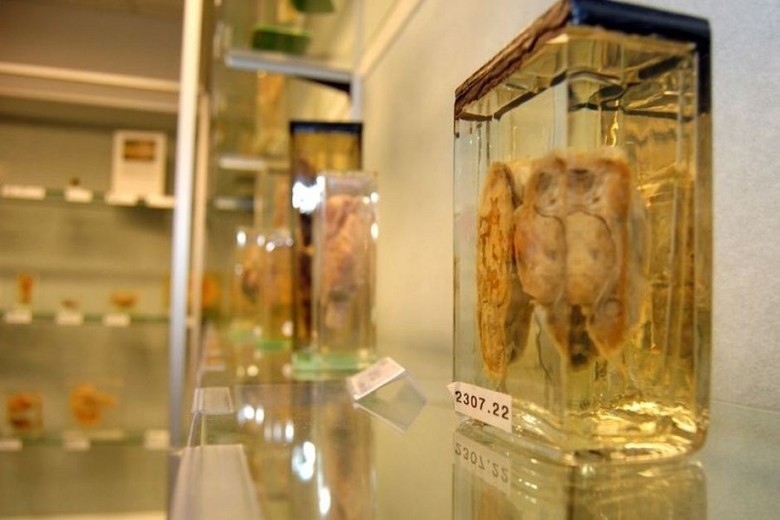 5 Museum Seram yang Berisi Organ Tubuh Manusia