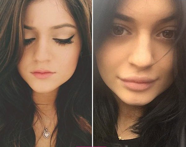 Tidak Pakai Lipstik, Kylie Jenner Ketahuan Operasi Bibir