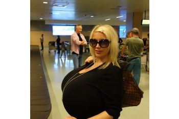 Sosok Beshine, Wanita dengan Payudara Palsu Terbesar di Dunia