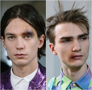 Para Model Ini Tampil di Catwalk dengan Wajah Lebam dan Bibir Pecah