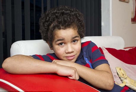 Nyaris Koma Karena Kecelakaan, Tengkorak Bocah Ini Ditanam di Perut