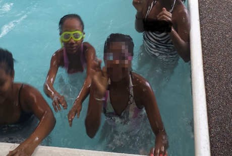 Air Kolam Kebanyakan Klorin, Kulit 5 Bocah Ini Terbakar Usai Berenang